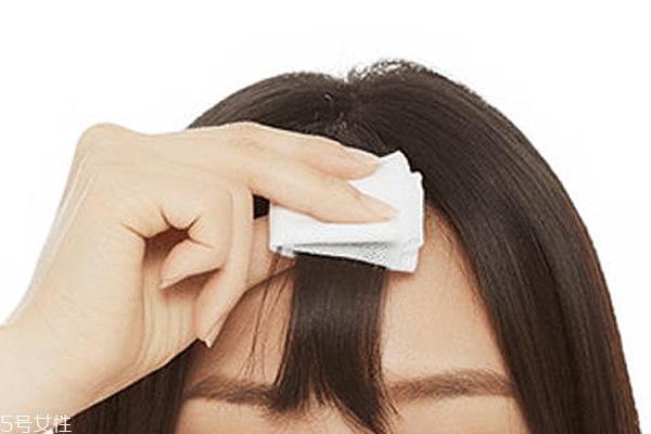 夏天刘海油腻怎么去油 刘海油腻4个拯救方法