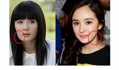 ​有些明星明明从方脸变成了尖脸，却说自己没整过？进来看看都有谁