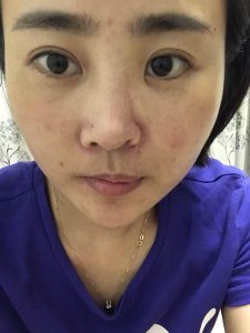 ​女游客丽江被打毁容案宣判 当事人：疤痕一辈子都修复不了