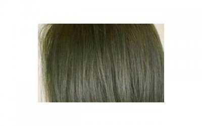 ​禁欲太久精子变黄？黄的精子怎么变回白色