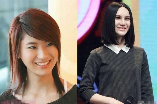 尚雯婕的脸到底怎么了为什么总挡着？尚雯婕整容前后照片对比恐怖