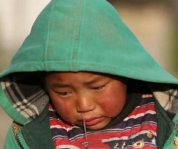 ​还记得《变形计》四爷？爱流鼻涕的他，近照曝光后：差点认不出