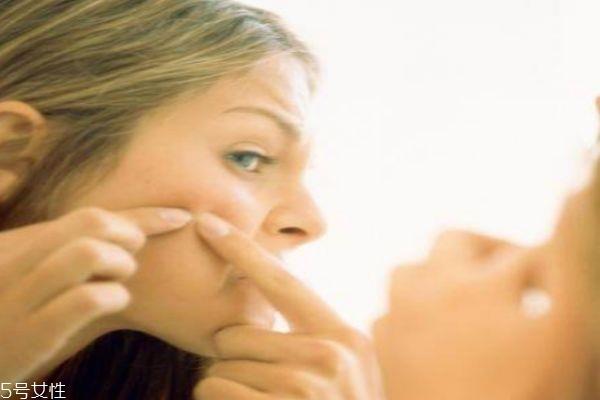 激素脸的症状 三种症状检测你是否是激素脸 激素脸的症状 三种症状检测你是否是激素脸